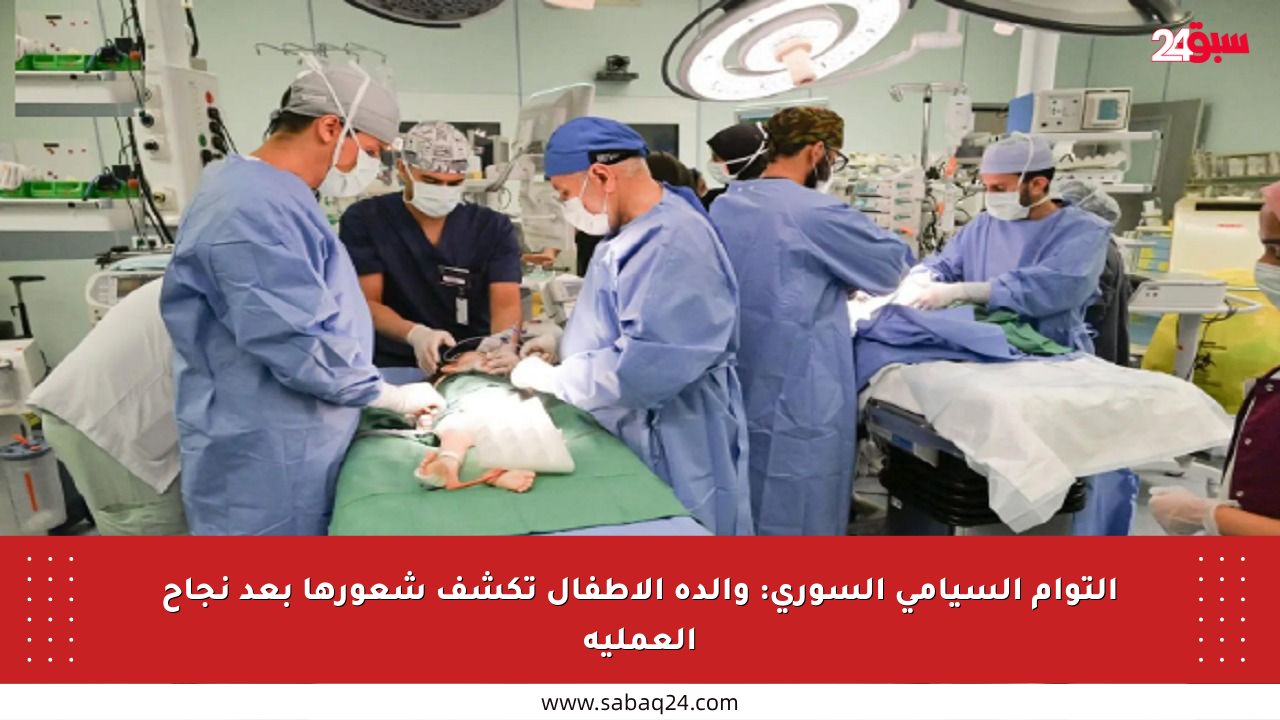 التوأم السيامي السوري: والدة الأطفال تكشف شعورها بعد نجاح العملية